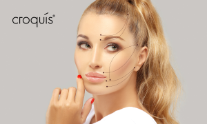 Facelift