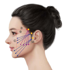 Mid & Lower Face Lifting
