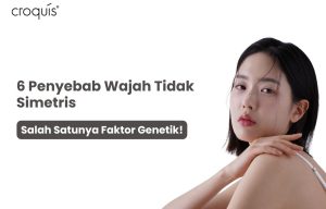 Penyebab wajah tidak simetris