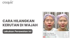 cara menghilangkan kerutan di wajah