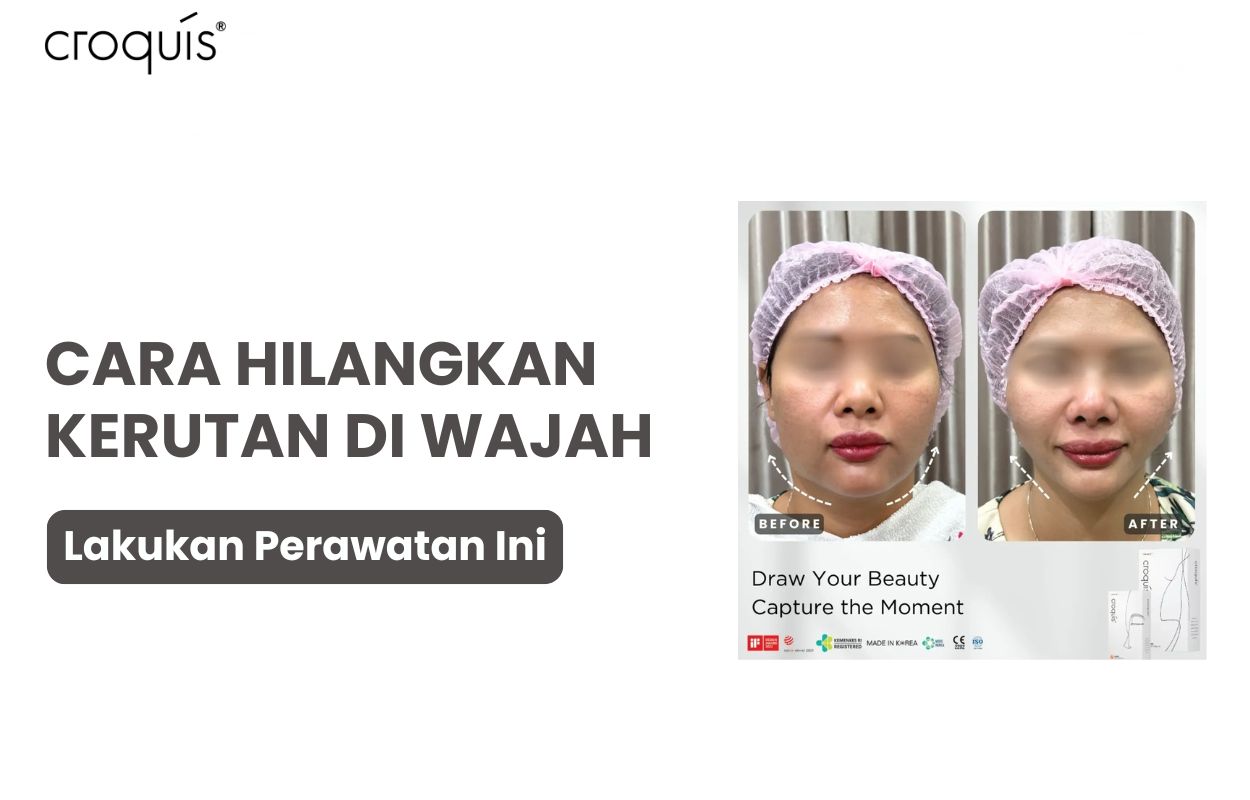 10 Cara Menghilangkan Kerutan di Wajah dengan Mudah dan Cepat - Croquis