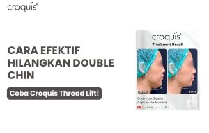 cara menghilangkan double chin dalam 3 hari​