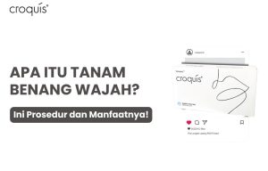 apa itu tanam benang