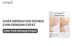 cara mengatasi double chin
