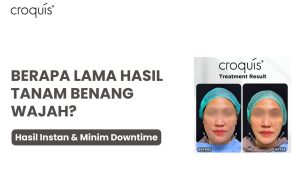 berapa lama tanam benang terlihat hasilnya